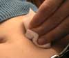 Pr&eacute;paration du site d'injection
