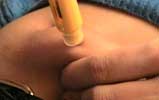 Injection